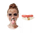 Dentadura blanca FX con diente de oro