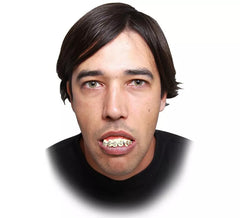 Zahnersatz mit Brakets
