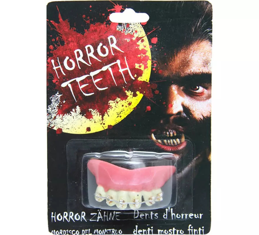 Translation missing: de.Dentadura con Brakets