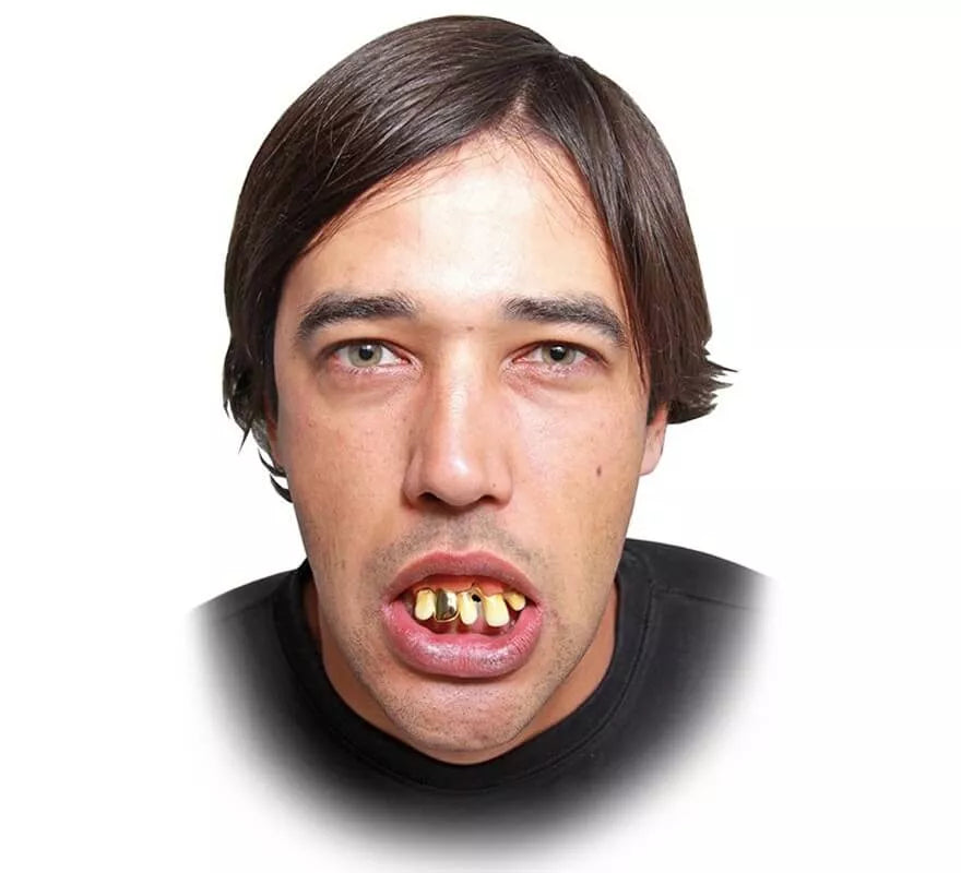 Translation missing: de.Dentadura con diente de oro