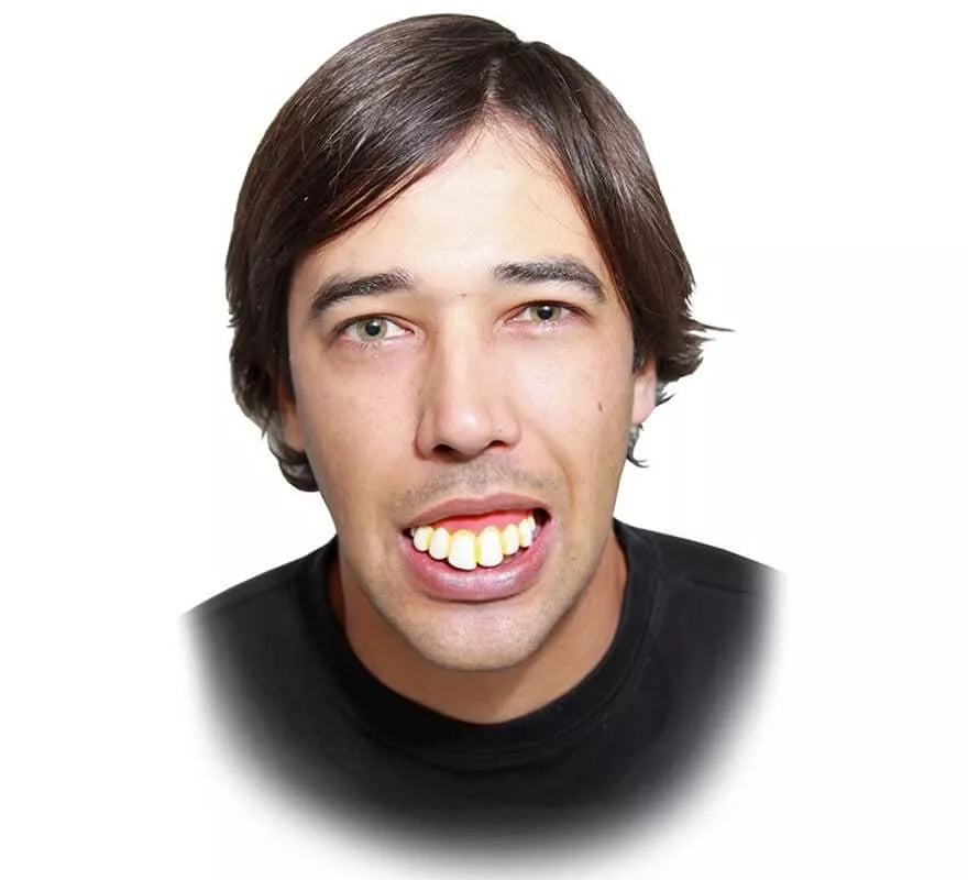 Translation missing: de.Dentadura con dientes extra grande